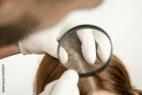 Doctor examining womans hair scalp, scalp eczema, dermatitis, psoriasis, hair loss, dandruff or dry scalp problem photo