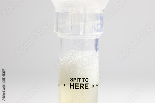 DNA saliva collection tube