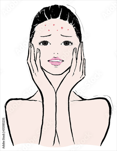 ニキビに悩む女性