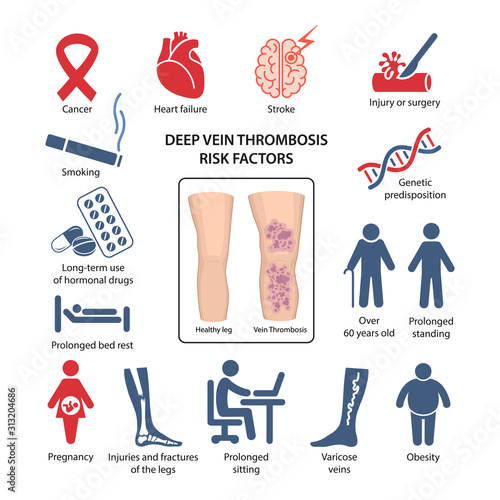 Deep vein thrombosis risk factors in the form of icons with corresponding marks. Vector illustration in flat style isolated on white background.