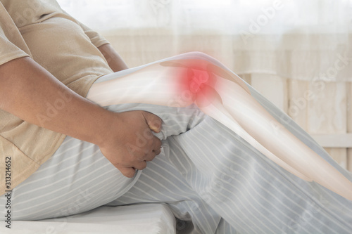 Obesity knee pain Musculoskeletal inflammation. And the legs support too much weight