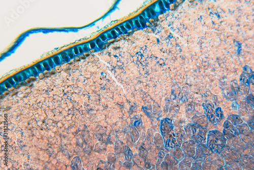 Tableau sur toile Medical Lab Prepared microscopic- weevil rye