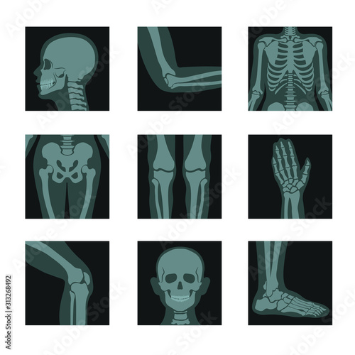Skeleton and bones x-ray shots, head and hands, legs and joints