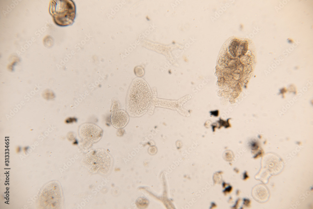 Study Movement and Specimens of Transversotrema patiallensis (parasite) under the microscopic in laboratory.