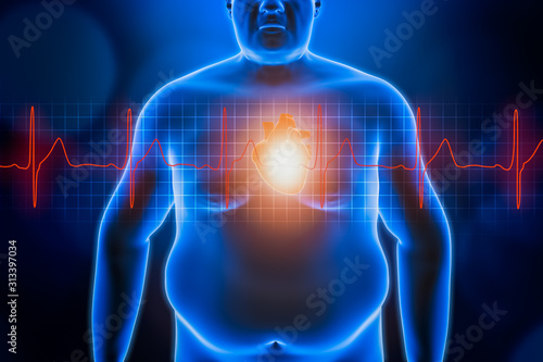 Fat or obese man chest body with heart and red ekg heartbeat curve. Blue futuristic hologram 3d rendering illustration. Obesity, healthcare, medical, wellness, heart disease concepts.