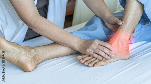 Canvas-taulu Ankle pain from instability, arthritis, gout, tendonitis, fracture, nerve compre