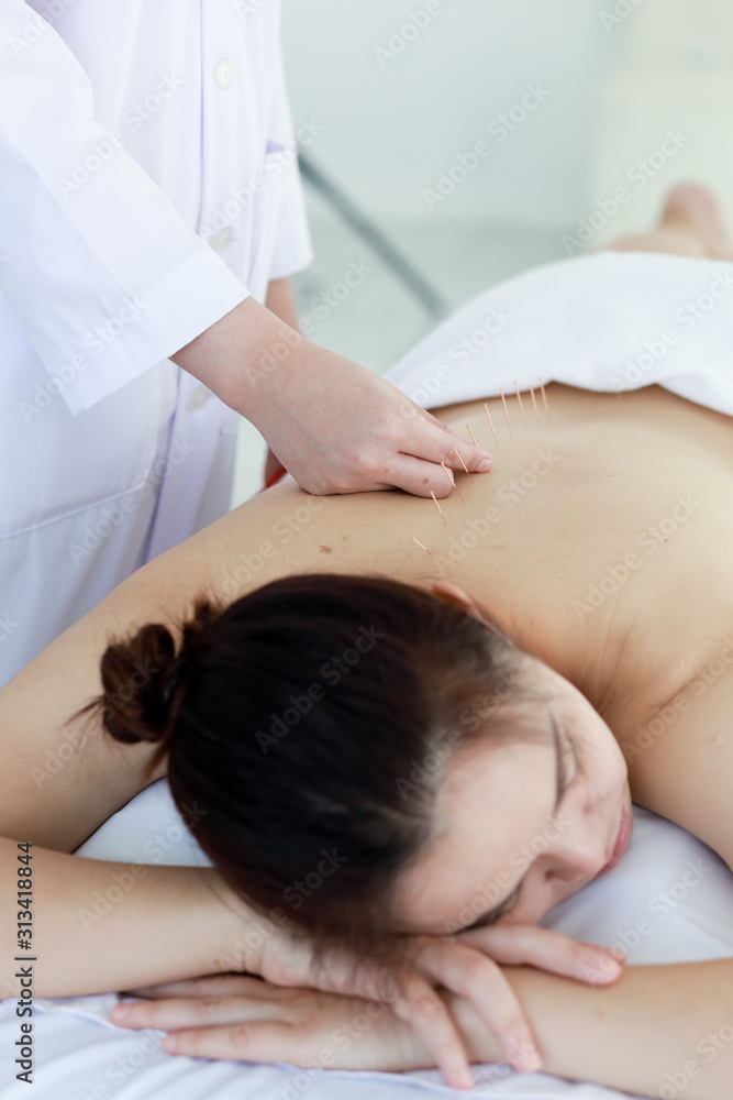 hand of doctor performing acupuncture therapy . Asian female undergoing acupuncture treatment with a line of fine needles inserted into the her body skin in clinic hospital hand of doctor performing acupuncture therapy . Asian female undergoing acupuncture treatment with a line of fine needles inserted into the her body skin in clinic hospital