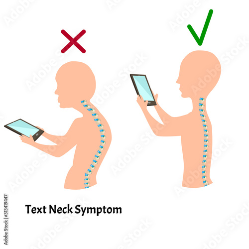 Improper posture symptoms. Text Neck Syndrome. Spinal curvature, kyphosis, lordosis, scoliosis, arthrosis. Improper posture and stoop. Infographics. Vector illustration.