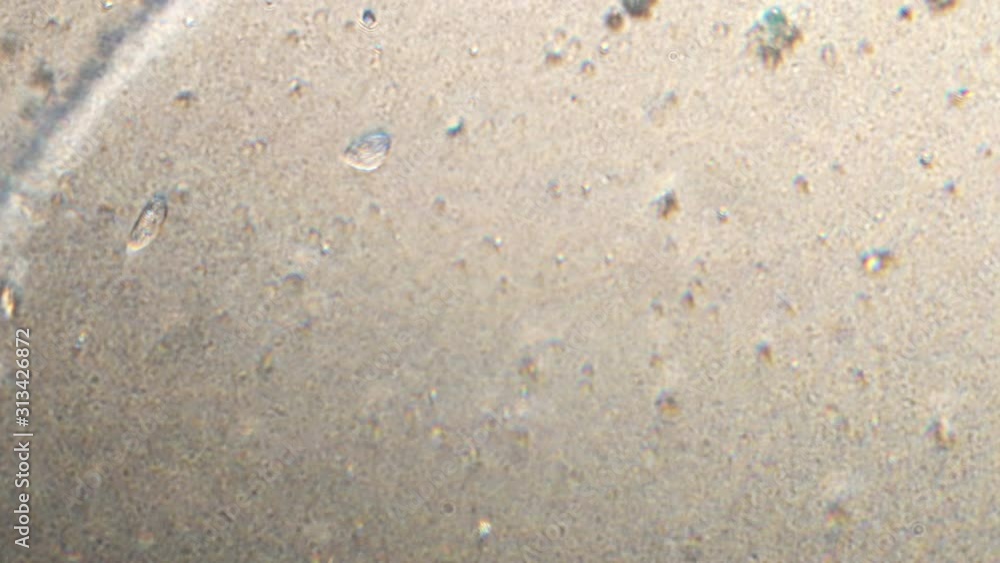 Microscopy of protozoa and small microorganisms in the water sample. Magnification 150x cells in active movement. Microscopy of protozoa and small microorganisms in the water sample. Magnification 150x cells in active movement.