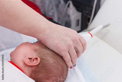Ultrasound examination of the head. Examination of a month old baby
