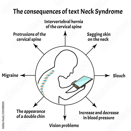 Consequences of Text Neck Syndrome. Spinal curvature, kyphosis, lordosis of the neck, scoliosis, arthrosis. Improper posture and stoop. Infographics. Vector illustration on isolated background photo
