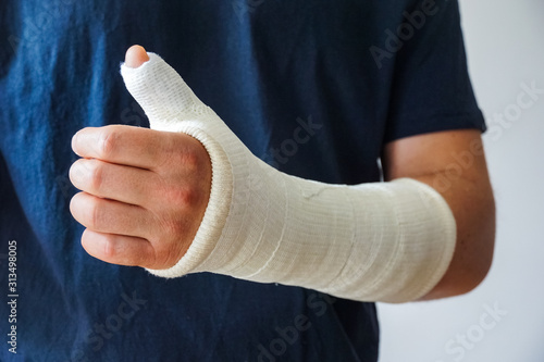 Bild auf Leinwand Man with plaster cast on broken hand, broken thumb,broken wrist