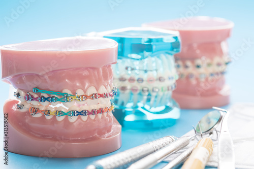 orthodontic model and dentist tool - demonstration teeth model of varities of orthodontic bracket or brace photo