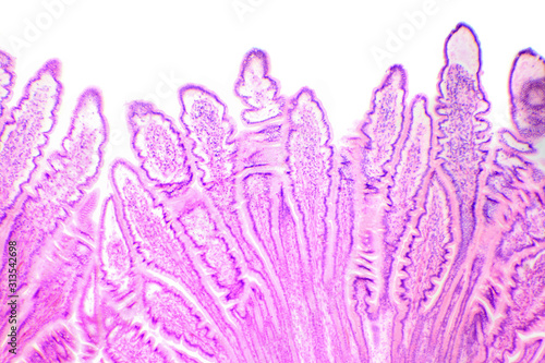 Сross-section of the small intestine under the microscope (Small Intestine Sec.)