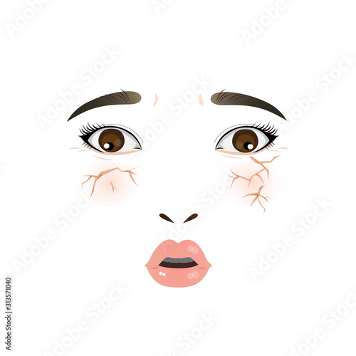 Close up face - woman has dry skin on her face.