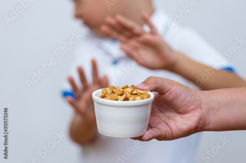 Quadro su tela Peanut food allergy concept