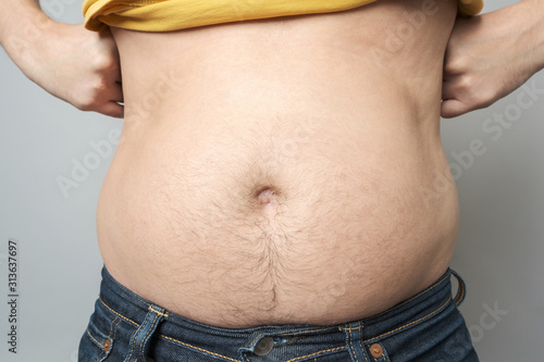 Man showing his fat on the stomach