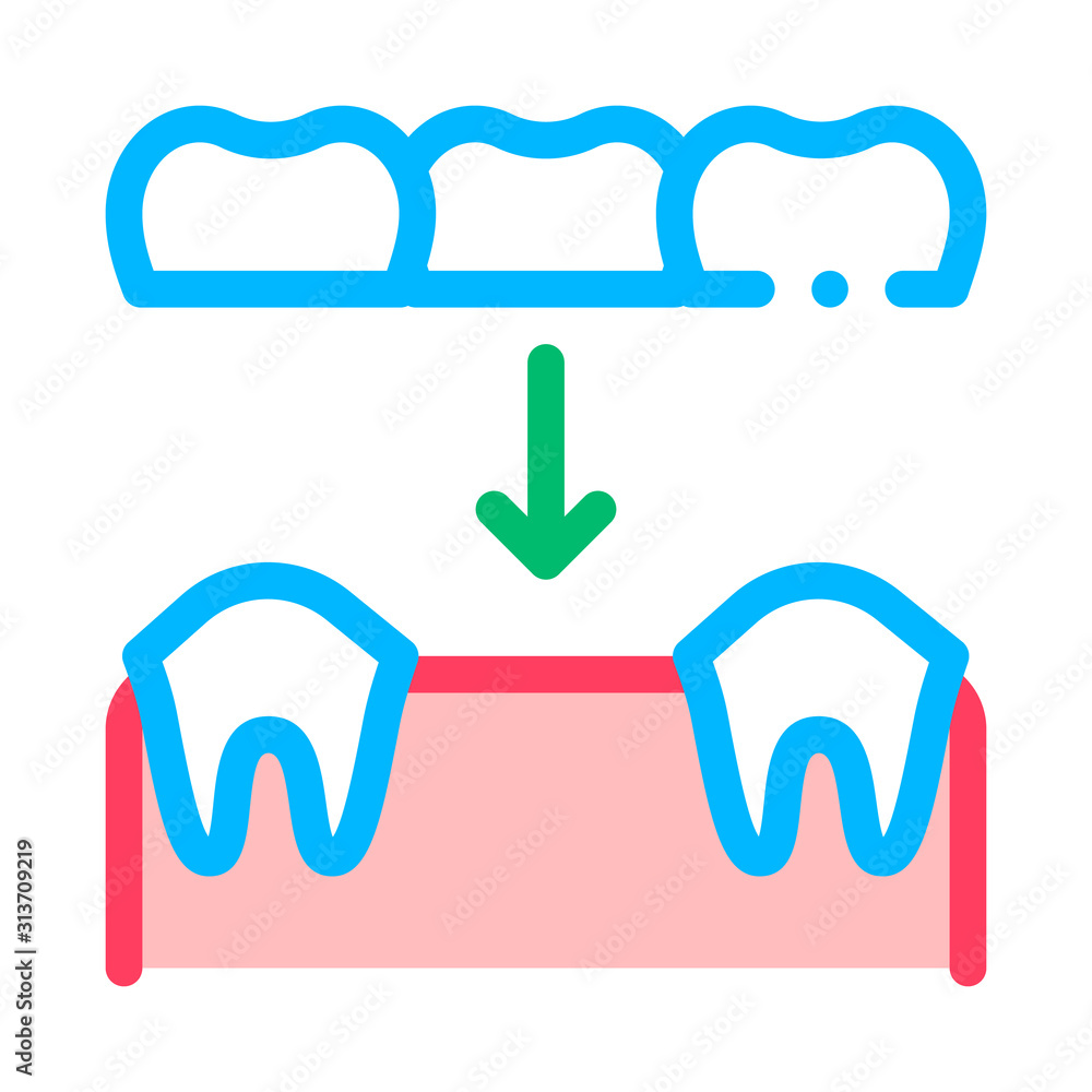 Dental Prosthesis Stomatology Vector Sign Icon Thin Line. Stomatology Dentist Instrument Equipment And Device Linear Pictogram. Medical Treatment Therapy Dentistry Contour Illustration Dental Prosthesis Stomatology Vector Sign Icon Thin Line. Stomatology Dentist Instrument Equipment And Device Linear Pictogram. Medical Treatment Therapy Dentistry Contour Illustration