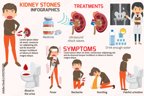Detail medical set elements and symptoms with treatment of kidney stone infographics. vector illustration. Kidney stones disease infographics.