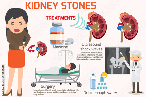 Detail medical set elements and symptoms with treatment of kidney stone infographics. vector illustration. Kidney stones disease infographics.