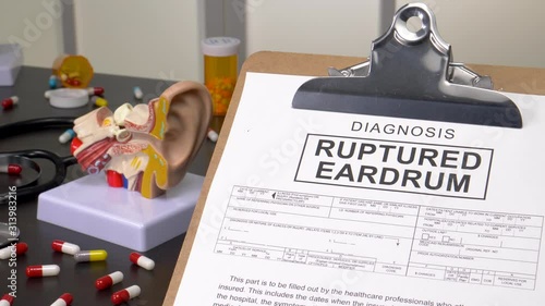 Ruptured Eardrum patient diagnosis on a medic office with pills, stethoscope and anatomy models. Camera panning reveling the notebook with the medical record copy. photo
