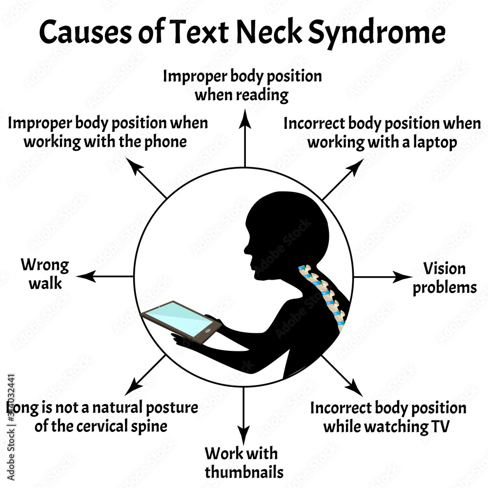 Causes of Text Neck Syndrome. Spinal curvature, kyphosis, lordosis of