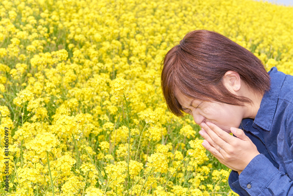 Fototapeta premium 菜の花畑でくしゃみをする若い女性