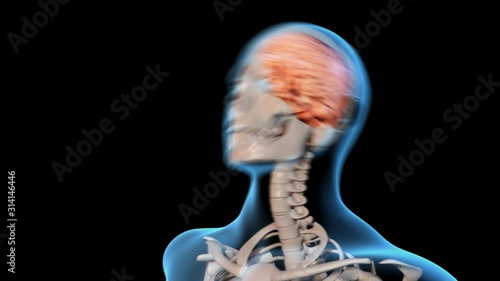 Brain Concussion