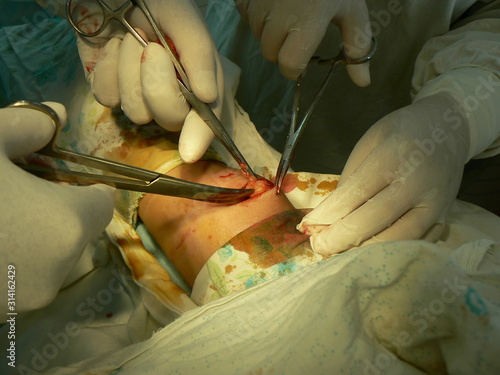 surgeon. operation