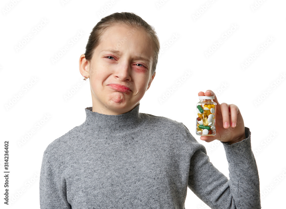Allergic reaction, skin rash, close view portrait of a girl's face. Redness and inflammation of the skin in the eyes and lips. Immune system disease. Bottle of tablets and pills in child hand. Allergic reaction, skin rash, close view portrait of a girl's face. Redness and inflammation of the skin in the eyes and lips. Immune system disease. Bottle of tablets and pills in child hand.