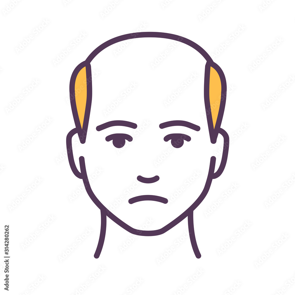 Man with a bald head color line icon. Baldness stage. Alopecia. Pictogram for web page, mobile app, promo. UI UX GUI design element. Editable stroke.