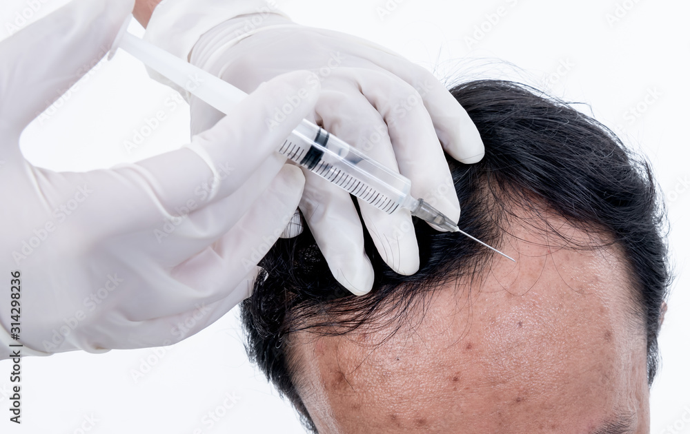 Top view images of a man receiving treatment With injections serum on ...