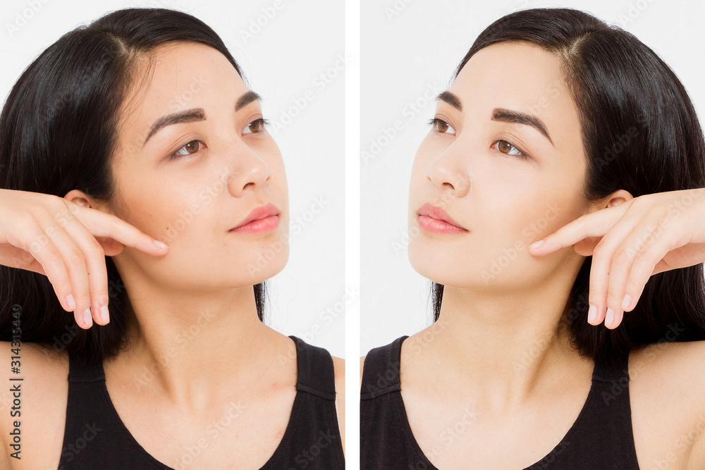 Asian close up woman happy face before after cosmetic procedures. Skin care wrinkled face, dark circles under eyes. Before-after anti-aging facelift treatment. Facial skincare, beauty contouring Asian close up woman happy face before after cosmetic procedures. Skin care wrinkled face, dark circles under eyes. Before-after anti-aging facelift treatment. Facial skincare, beauty contouring