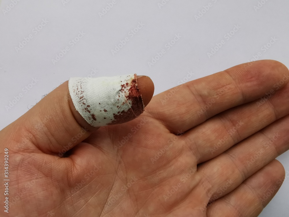 A bandaged finger a bloody wound a patch of blood. Injured male
