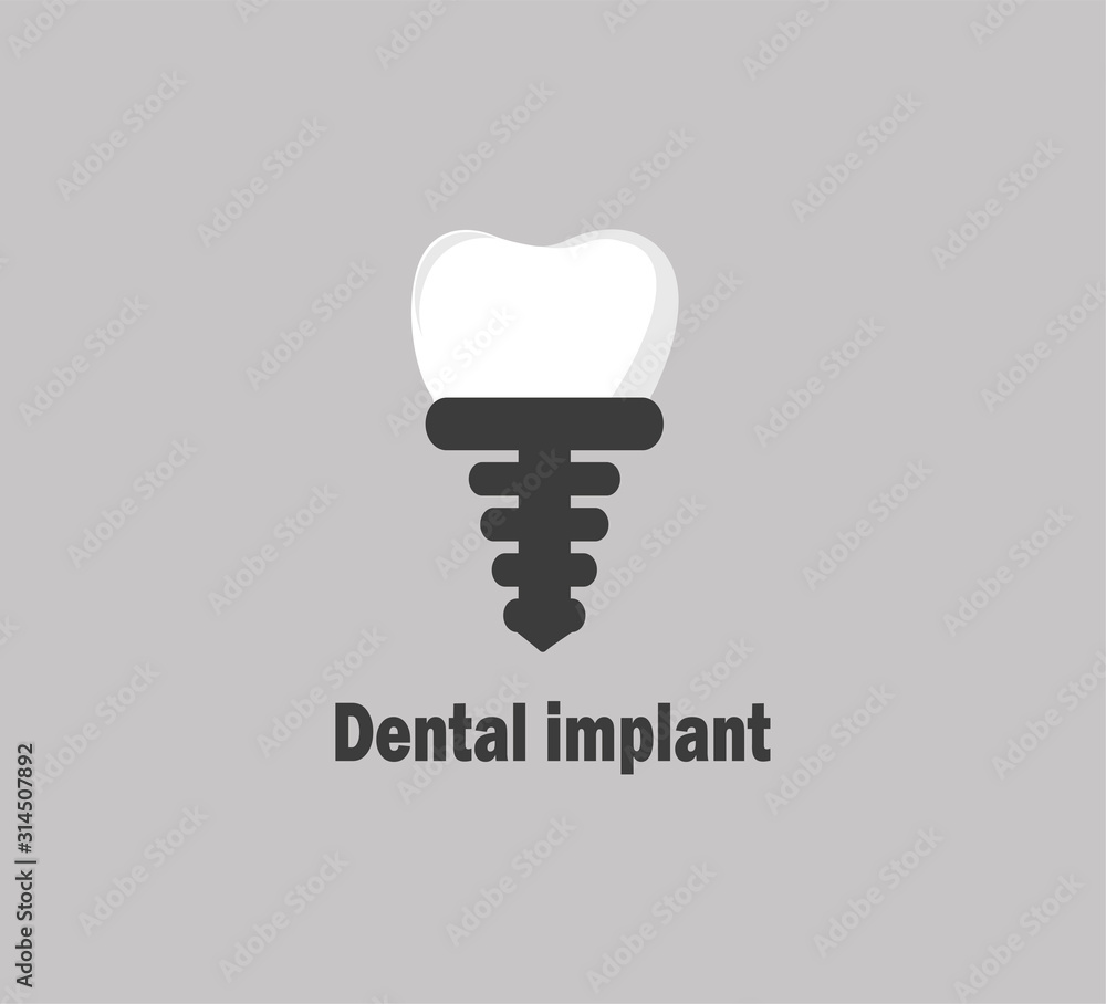 Vector icon - dental implant. Dental logo vector layout - prosthetics and dental treatment
