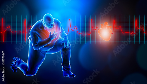 Obese of fat man kneeling while suffering from a heart attack 3d rendering illustration. STEMI heart rate EKG in the background and copy space. Medical and healthcare, myocardial infarction concept. photo