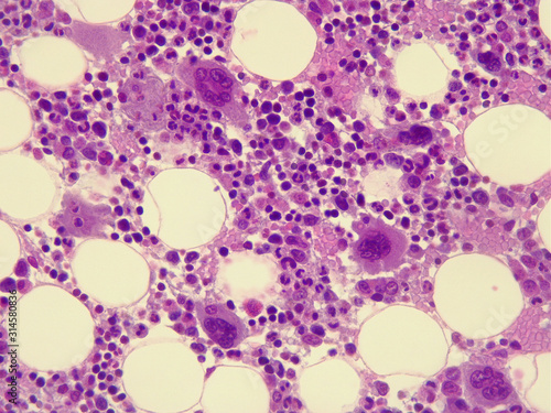 Slika na platnu Human bone marrow under the microscope. (400x magnification)