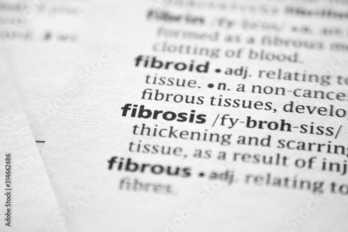 Word or phrase Fibrosis in a dictionary.