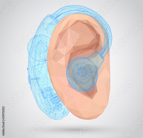 vector human ear. hearing treatment, plastic surgery, implantation