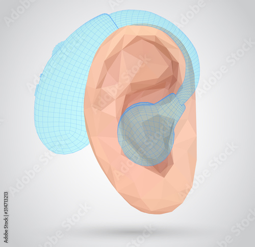 vector human ear. hearing treatment, plastic surgery, implantation