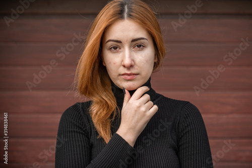 Acne and scars, simple woman close up natural portrait, No makeup and retouch. Problem skin