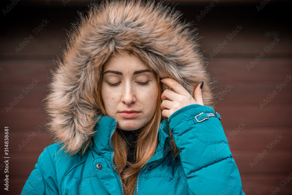 Acne and scars, simple woman close up natural portrait, No makeup and retouch. Problem skin Acne and scars, simple woman close up natural portrait, No makeup and retouch. Problem skin