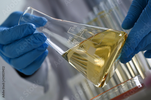 Foto Male hand hold yellow liquid in test tube