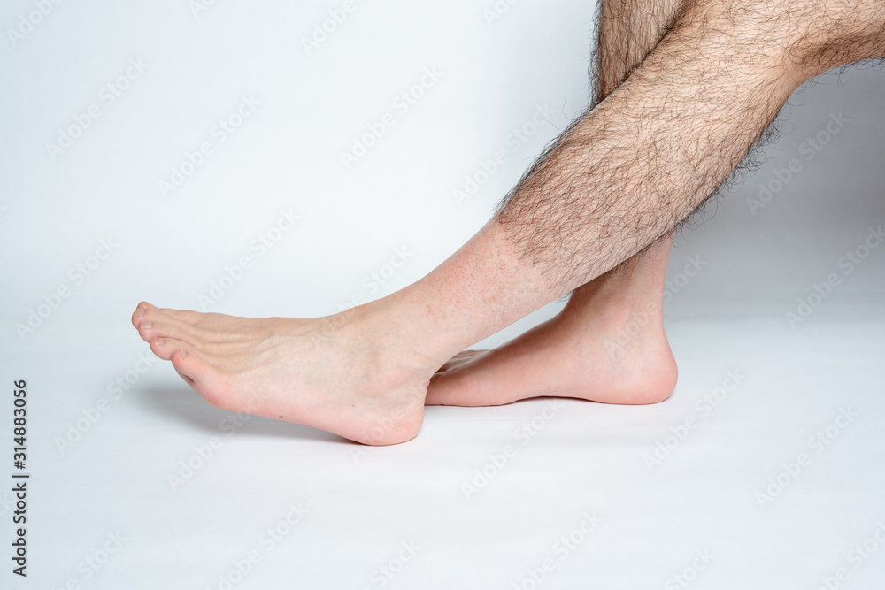 Legs hair removal for men, before & after. Applies only to visible space  when wearing pants. Stock Photo | Adobe Stock