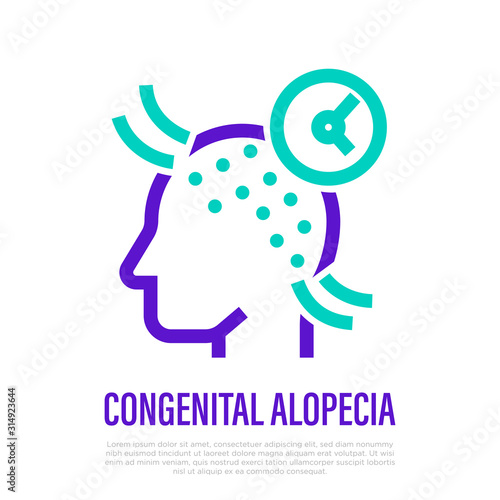 Congenital alopecia thin line icon. Hair loss. Bald place on scalp. Vector illustration.