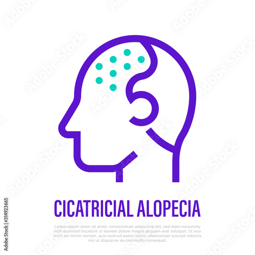 Cicatricial alopecia thin line icon. Hair loss. Bald place on scalp. Vector illustration.