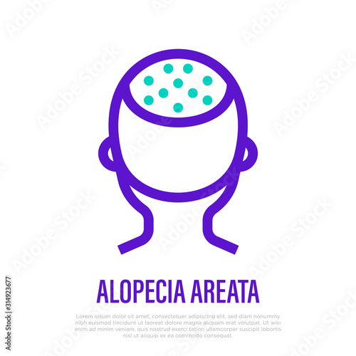 Areata alopecia thin line icon. Hair loss. Bald place on scalp. Vector illustration.
