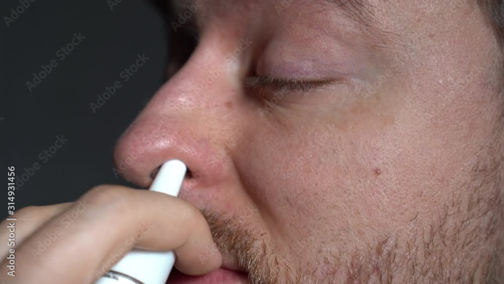 Video „Unhealthy man with red irritated eyes splashing small dose of