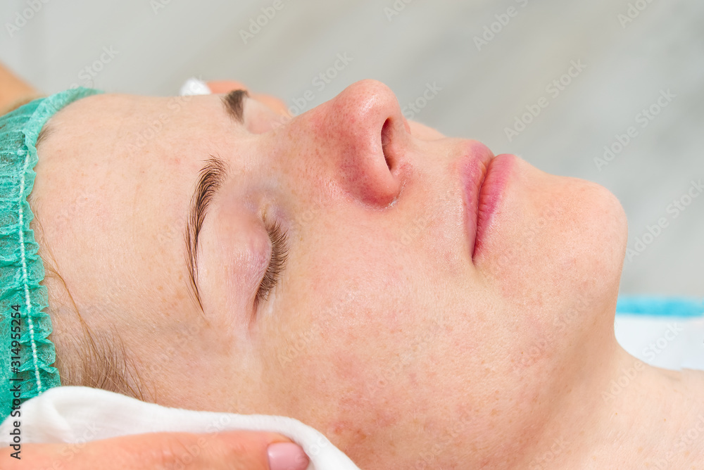 Beautician cleans face. Young woman in a beauty salon. Cosmetology concept. The cosmetologist performs a procedure to cleanse the face with problem skin. Anti age and wrinkle. Beautician cleans face. Young woman in a beauty salon. Cosmetology concept. The cosmetologist performs a procedure to cleanse the face with problem skin. Anti age and wrinkle.