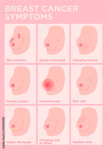 Breast cancer symptoms poster